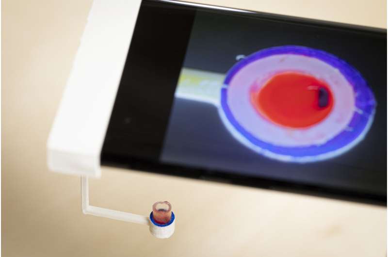 Smartphone app can vibrate a single drop of blood to determine how well it clots
