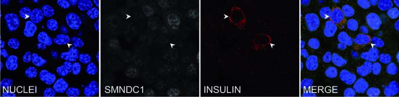 SMNDC1 loss induces alpha cells to produce insulin