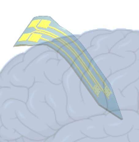 La sonda cerebral blanda podría ser una gran ayuda para la investigación de la depresión