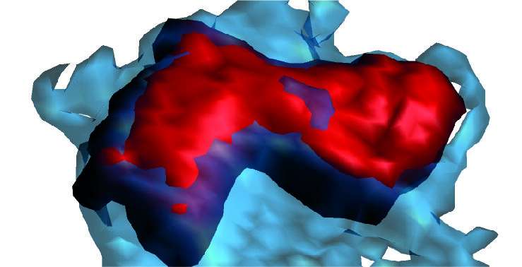 Spanish scientists discover a cell behavior pattern that predicts cardiovascular disease