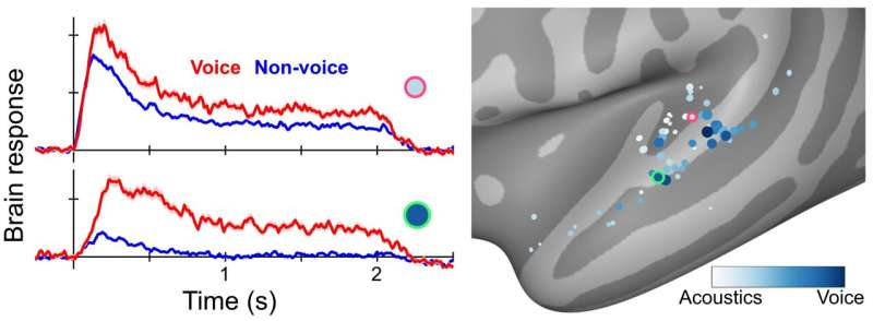Specialized brain regions recognize vocal cues that don't involve speech