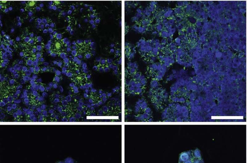 Stem cell-derived organoids mimic human parathyroid tissue