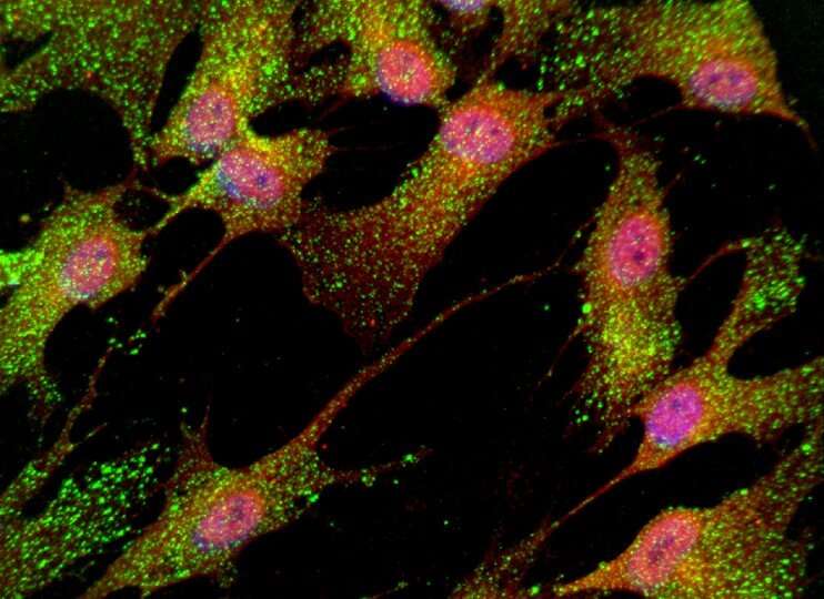 Stem cells may help identify new Schizophrenia drugs