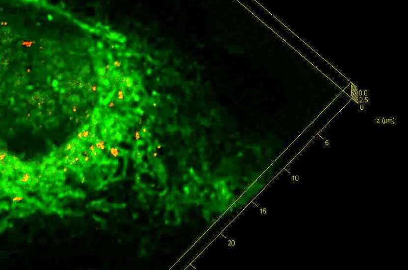 'Stressed' cells offer clues to eliminating build-up of toxic proteins in dementia thumbnail