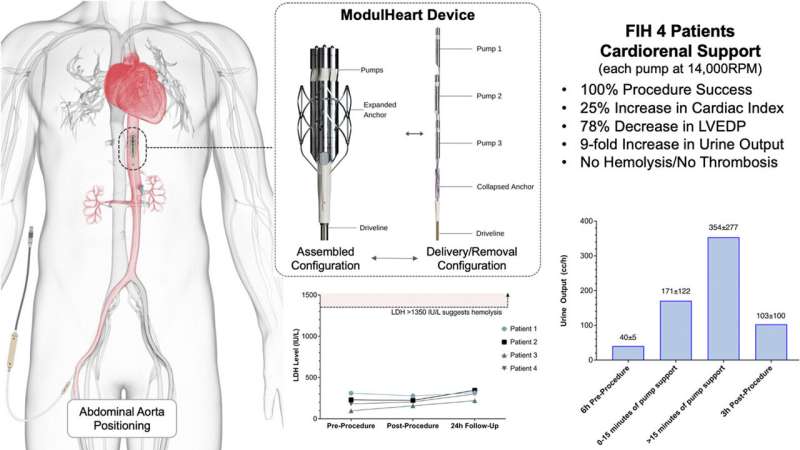 Study finds mechanical circulatory support and renal perfusion success with the ModulHeart device