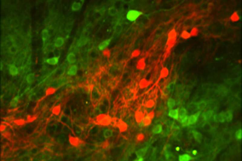 Study finds neurons that encode the outcomes of actions