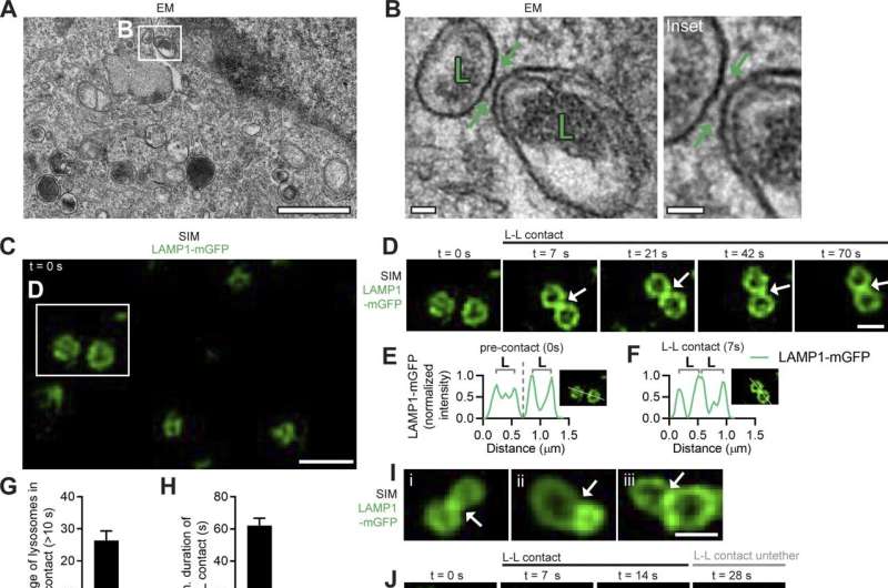 Study investigates crosstalk between mitochondria and lysosomes