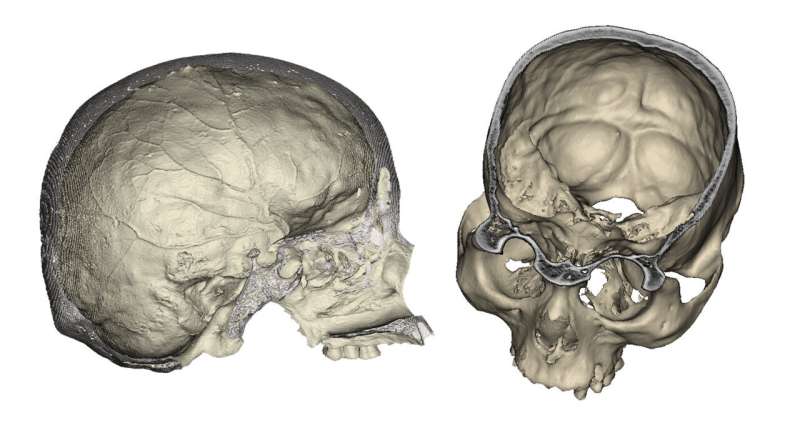 Study of the internal vascular system of the skull in American populations of the late Holocene