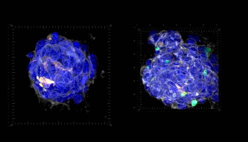 مطالعه بر روی تعامل تومور/سلول ایمنی می تواند بر ایمنی درمانی سرطان تأثیر بگذارد