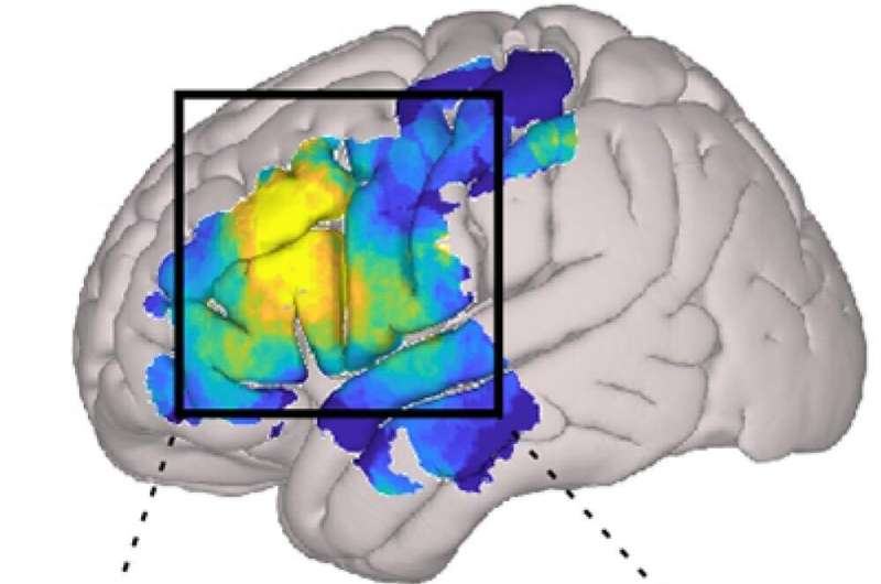 Study reveals brain networks enabling human conversation