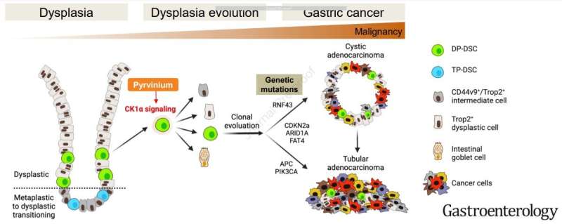 Study reveals how gastric cancer forms, suggests preventive treatment