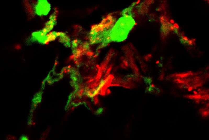 Study reveals new mode of triggering immune responses