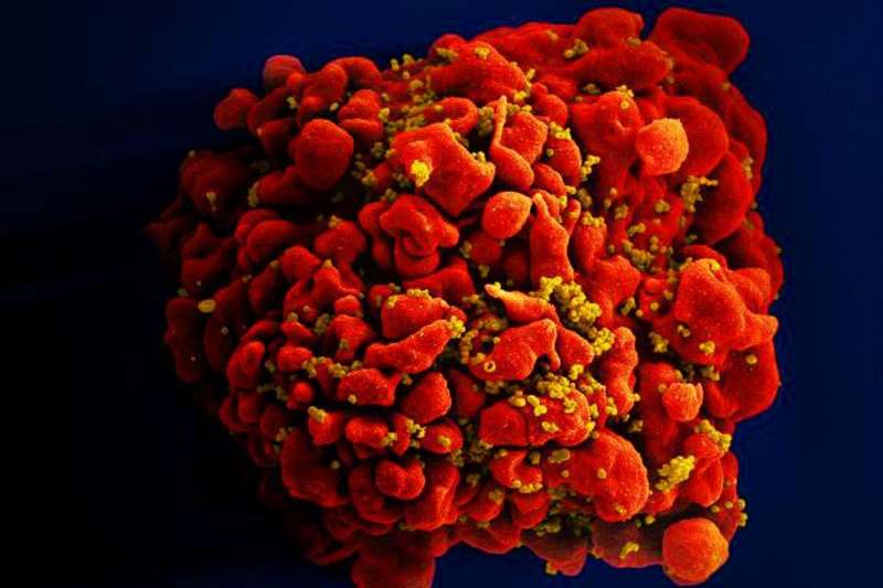 Study shows HIV speeds up body's aging processes soon after infection