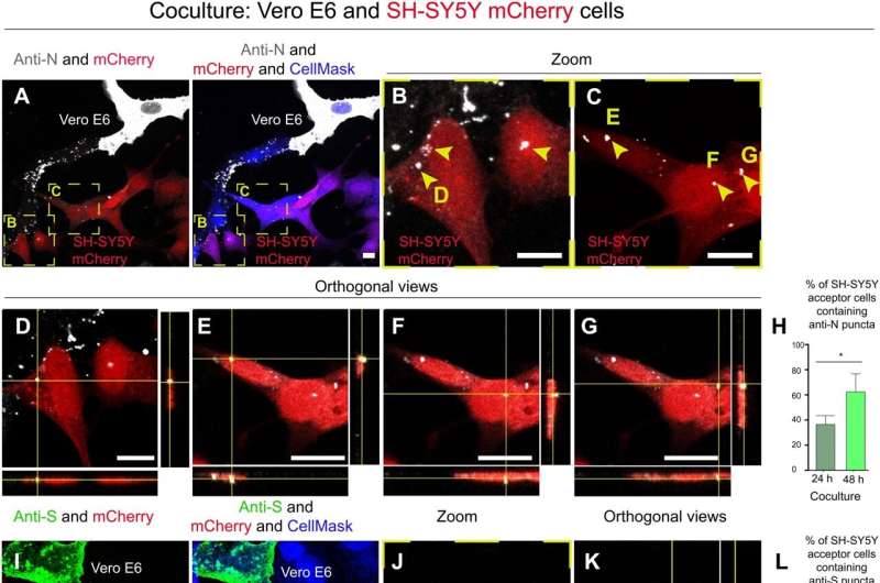 Study suggests SARS-CoV-2 virus enters the brain by using nose cells to make nanotube tunnels