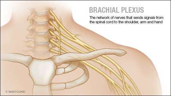Surgical options to treat brachial plexus injuries