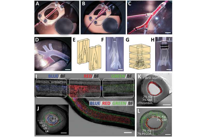 Researchers turn to age-old molding technique to 3D-print cell-laden vascular models