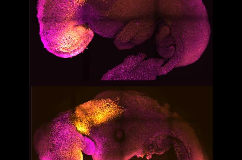 'Synthetic' embryo with brain and beating heart grown from multiple stem cells by Cambridge scientists