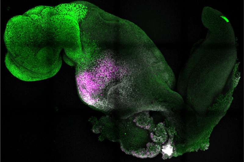 'Synthetic' embryo with brain and beating heart grown from multiple stem cells by Cambridge scientists