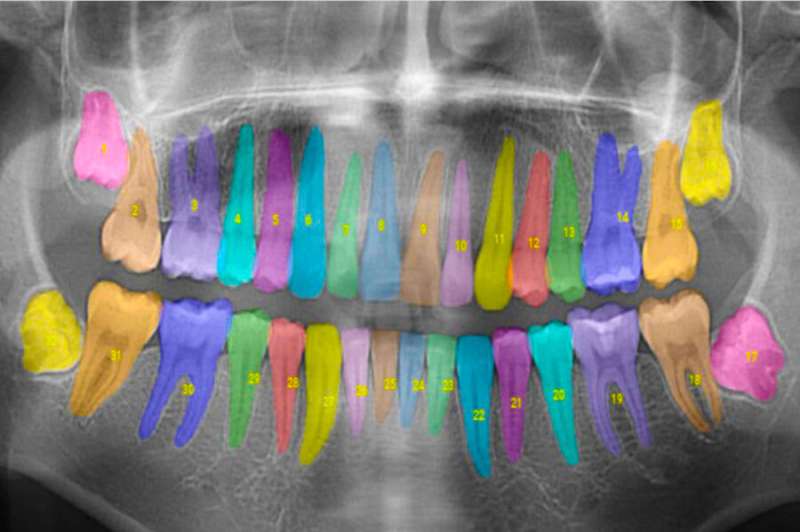 Taking the guesswork out of dental care with artificial intelligence