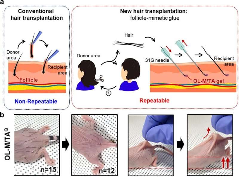 Team develops biocompatible adhesive applicable to hair transplants
