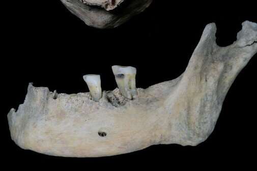 Teeth analysis gives hints of the diet of an Iron Age woman