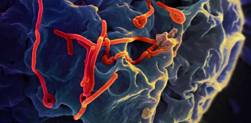 The Ebola virus can 'hide out' in the brain after treatment and cause recurrent infections