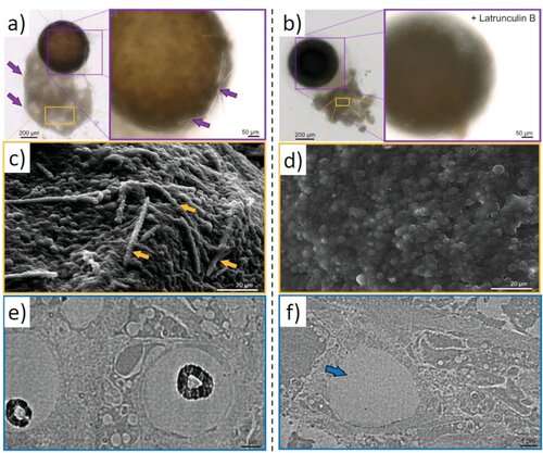 The evolutionary role of actin within sophisticated architectures of biosilica in sponges