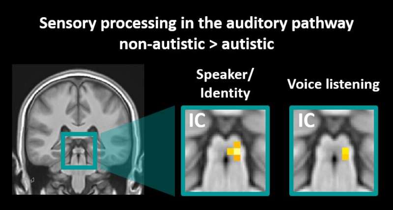 The neural mechanisms behind autism: Altered sensory processing of communication signals