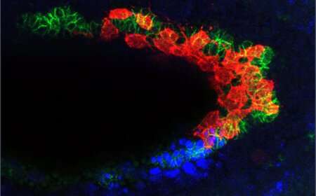 The Signals that Make Cells Self-Destruct