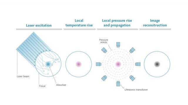 The sound of light: photoacoustics for biomedical applications