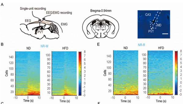 Time-restricted feeding can alleviate excessive dark-phase sleepiness, scientists discover