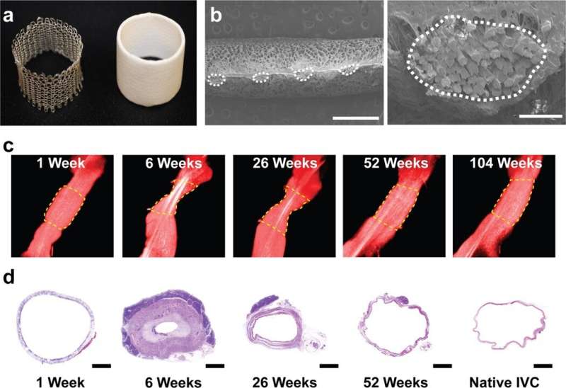 Tissue engineered vascular grafts transform into autologous neovessels with biomimetic function