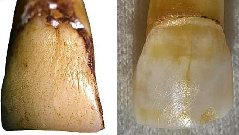 Tooth study prompts rethink of human evolution