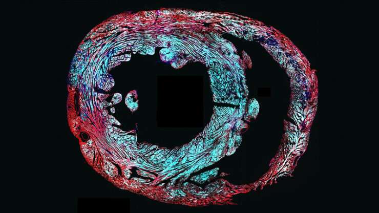 Tweaked genes borrowed from bacteria excite heart cells in live mice