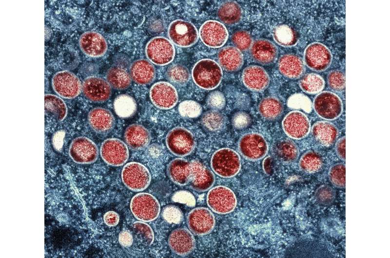 UK: 'Early signs' that monkeypox outbreak may be peaking