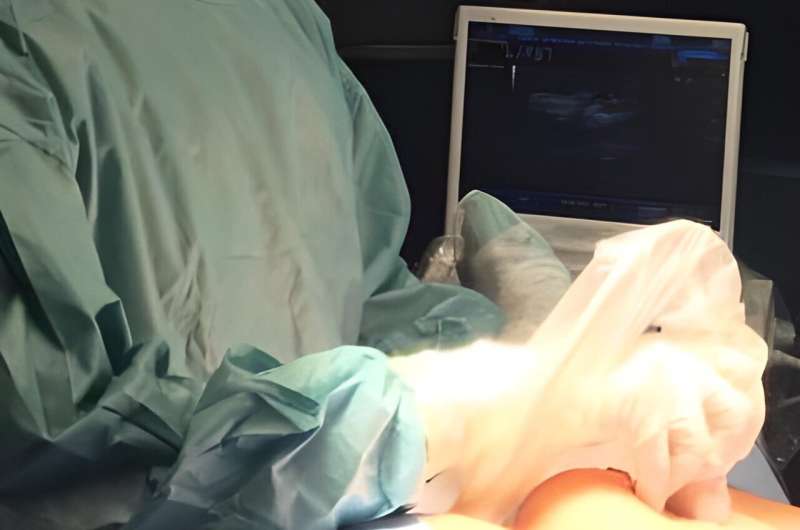 Ultrasound-guided surgery is quicker, less painful and more effective for treating early form of breast cancer