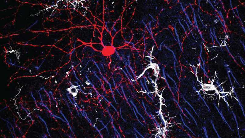 Uncovering how immune cells nurture brain connections