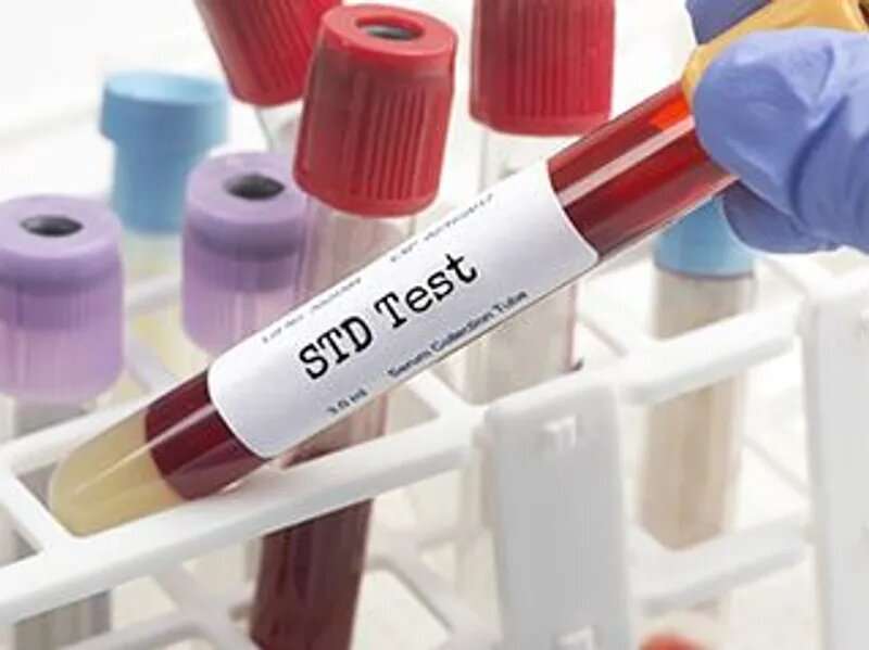 U.S. STD cases spiked during pandemic