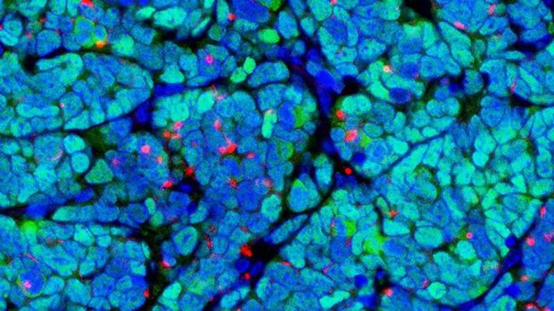 Viral proteins key to tumor model in mice