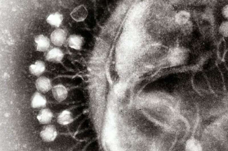 Viruses Gain Upper Hand