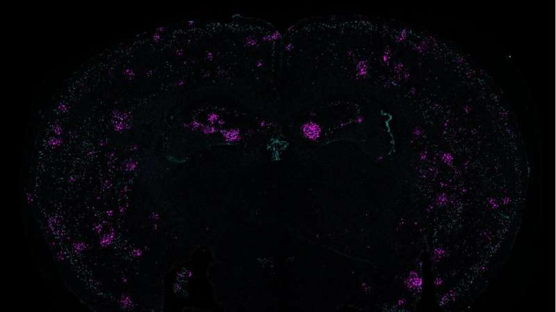 With fractured genomes, Alzheimer's neurons call for help