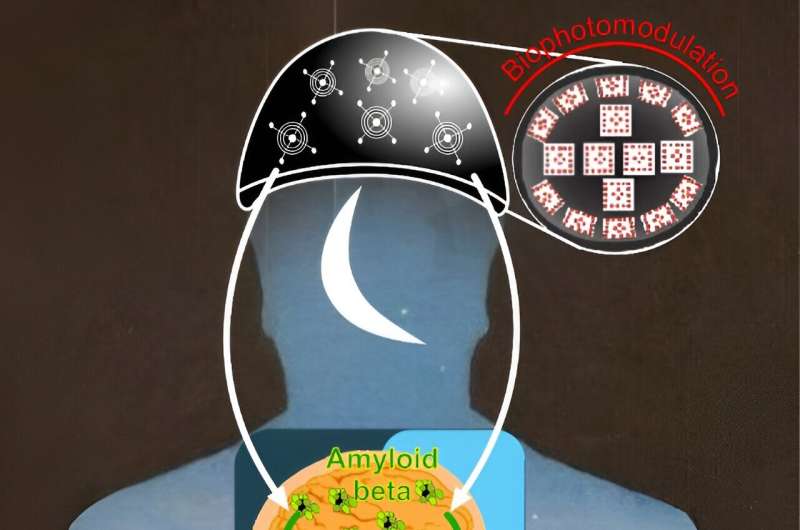  Phototherapy of Alzheimer’s disease during sleep