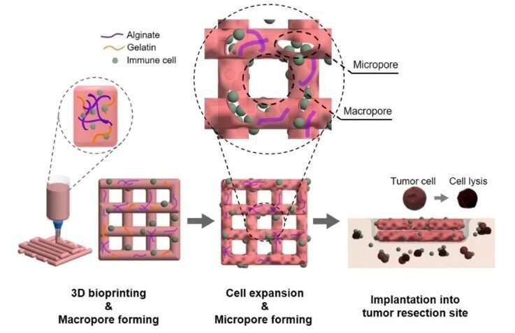 3D bioprinting technology to be used for removing cancer cells