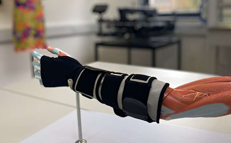 A smart glove to improve stroke rehabilitation