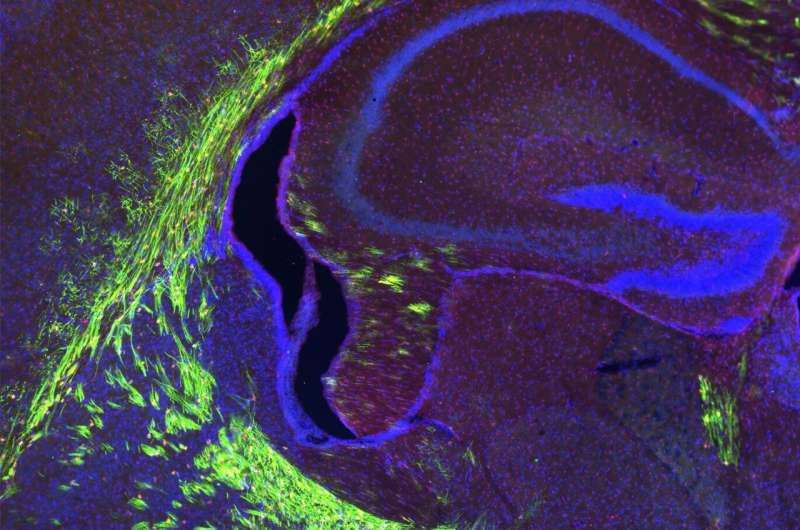 Um lipídio especial de ácido graxo ômega-3 mudará a forma como olhamos para o cérebro em desenvolvimento e envelhecimento, descobriram os pesquisadores da Duke-NUS