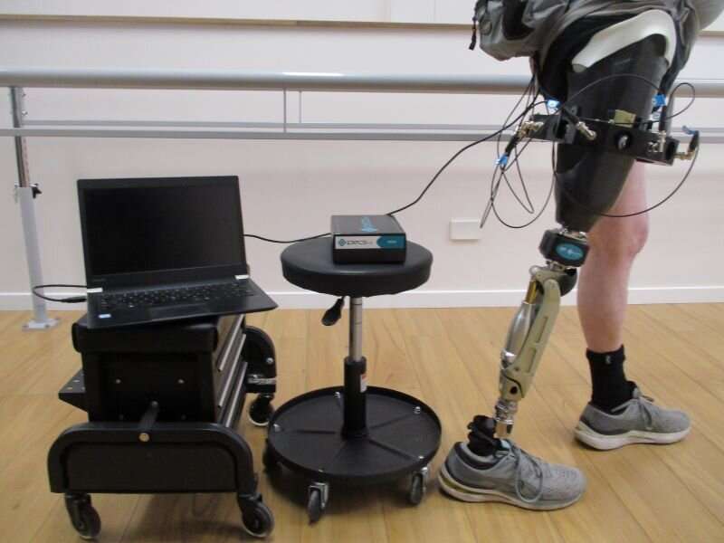 A step closer to streamlining the custom fit of bionic limbs for amputees