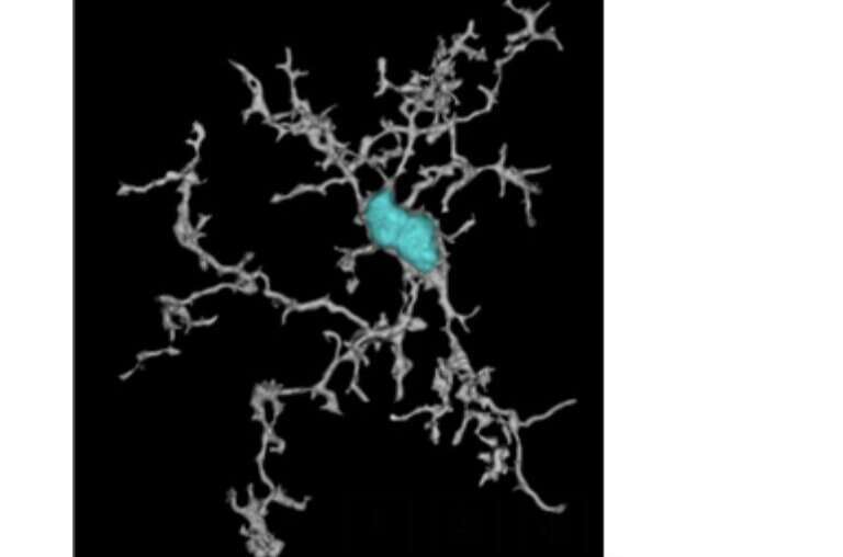 A TREM2 activating antibody with a transport vehicle that could boost the metabolism and function of brain microglia