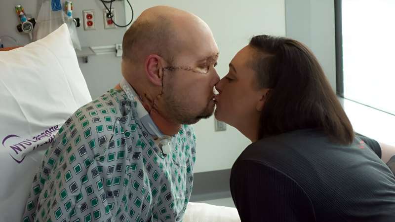 Aaron James (L) kisses his wife Meagan while he recovers from the first whole-eye and partial face transplant, at NY Langone Health in New York