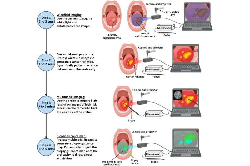 Accurate integrated imaging and projection system for oral cancer diagnosis
