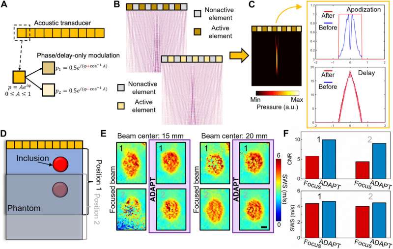 Acoustic diffraction–resistant adaptive profile technology for elasticity imaging